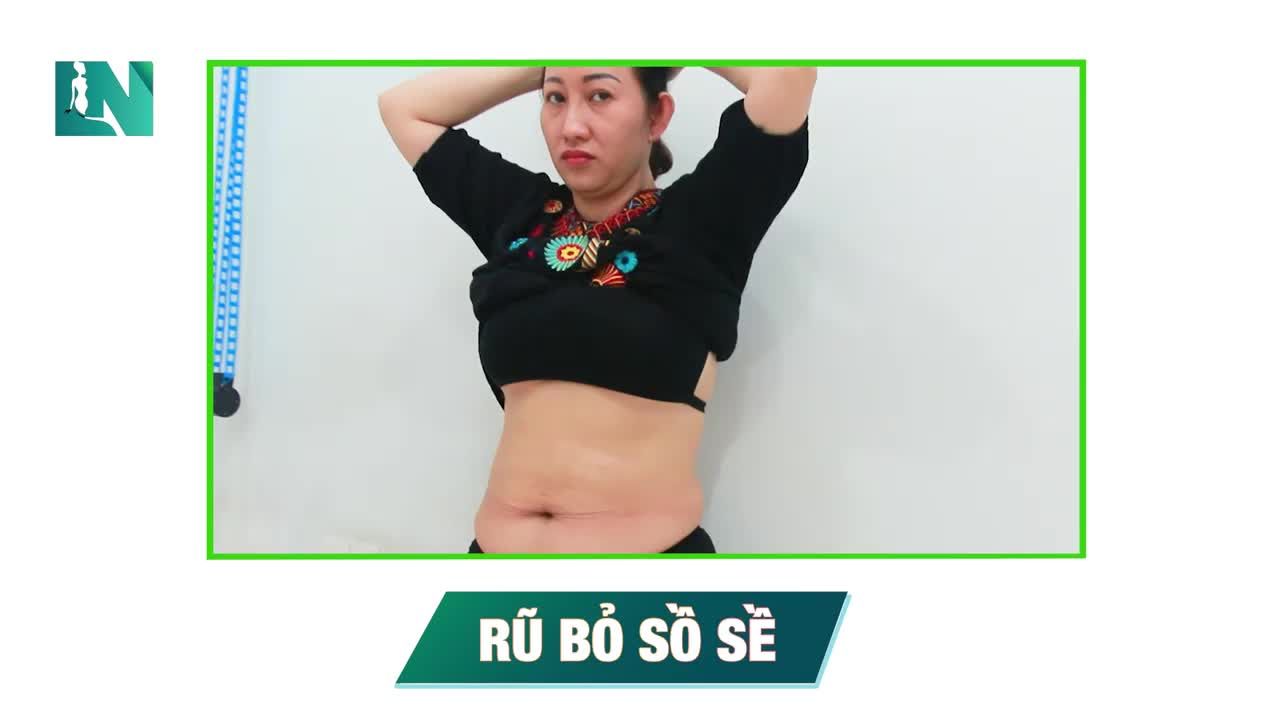 Rũ bỏ sồ sề - Trở về phiên bản ước mong.